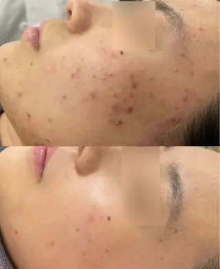 ネイル aliaハイフ&水光ジェットサロン所属・aliaハーブ水光店 エステティシャン募集のエステ・リラクイメージ