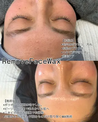 Remove所属・Remove .のエステ・リラクイメージ