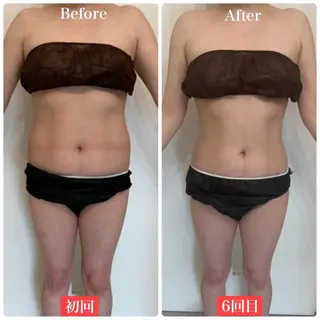 ララ/ハーブ メゾンリュバンのエステ・リラクイメージ