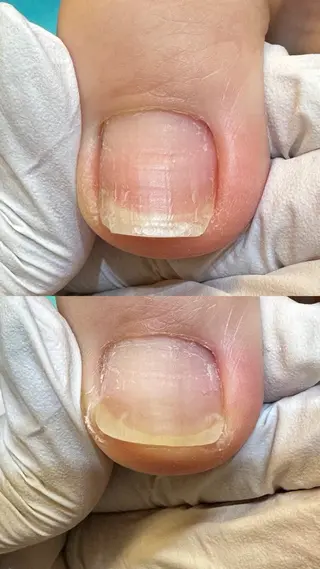 巻き爪補正店 横浜関内店のネイルデザイン