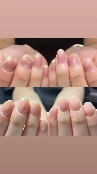 ネイル 自爪育成・巻き爪 補正講師　津蔵のネイルデザイン