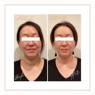 小顔×肌質改善サロン soin〔ソワン〕のエステ・リラクイメージ