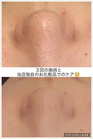 ニキビ・肌質改善専門 ♡人生が変わるサロンのエステ・リラクイメージ