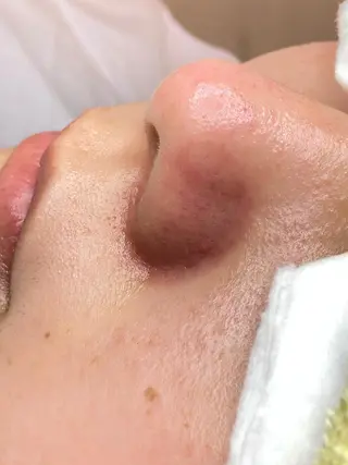 フェイシャルエステFOUATONS*所属・フェイシャルエステ ふわっとんのエステ・リラクイメージ