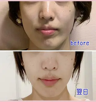 痛くない小顔矯正 小谷佳代子のエステ・リラクイメージ