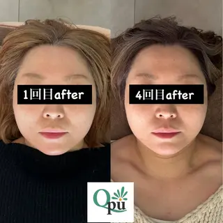 Qpu(キュープ)下北沢店所属・鮎川 さゆりのエステ・リラクイメージ