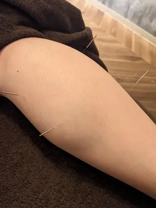 乃々鍼灸・整体院　表参道所属・乃々鍼灸整体院　植木 　【美容鍼/整体】のエステ・リラクイメージ