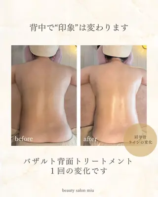 35歳からの エイジングケアサロンのエステ・リラクイメージ