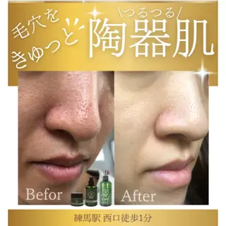 韓国肌管理/毛穴洗浄 💎ぷるる練馬/山口のエステ・リラクイメージ