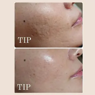 Ellebeauty relaxationのエステ・リラクイメージ