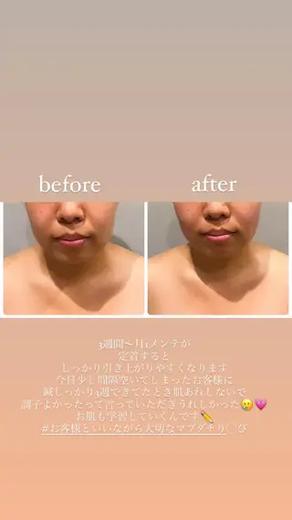 種市 貴子のその他イメージ