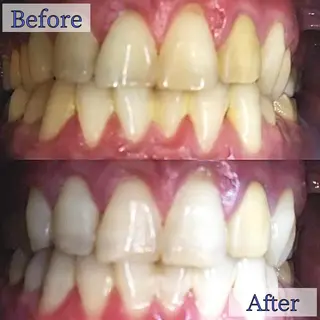 LBSホワイトニング 新宿店💝店長熊倉のその他イメージ