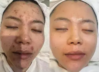 ショート aliaハイフ&水光ジェットサロン所属・aliaハーブ水光店 エステティシャン募集のエステ・リラクイメージ