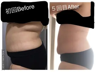 子宮矯正/腸揉み/ シュガーリング脱毛のエステ・リラクイメージ