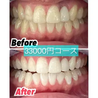 セミロング カラー パーマ ヘアアレンジ メンズ キッズ ネイル マツエク・マツパ アイブロウ プラチナムビューティー柏所属・【歯科提携】柏ホワイ トニングスタイルのその他イメージ