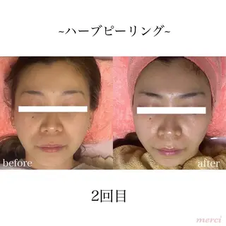 salon merci和泉のエステ・リラクイメージ