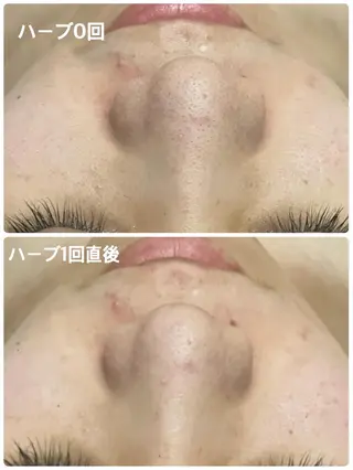 SALON BioBioのエステ・リラクイメージ