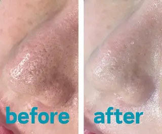 mimiBrun 肌質改善サロンのエステ・リラクイメージ