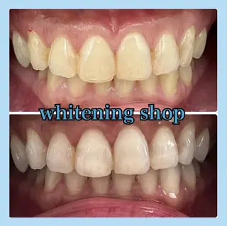 ホワイトニング ショップ千葉店のその他イメージ