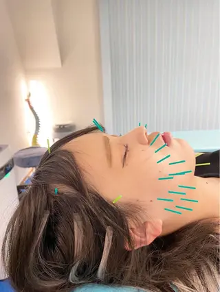 小顔美容鍼専門サロン 渋谷YZのエステ・リラクイメージ
