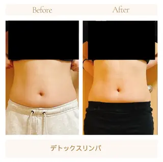 小顔・デトックスリンパ専門サロンRadiant Muse (ラディアントミューズ)所属・小顔・たるみ改善 ラディアントミューズのエステ・リラクイメージ