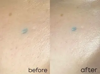 Mr.&Ms.脱毛 NATSUMIのエステ・リラクイメージ