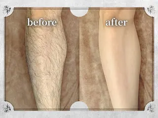 Lino by MIRA/Yuinaのエステ・リラクイメージ