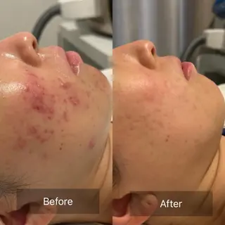 【美肌・脱毛専門店】 SARA 恵比寿店のエステ・リラクイメージ