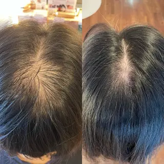 毛穴専門店MeMe.八千代店所属・\毛穴・頭皮/ のお悩みに特化💪のその他イメージ