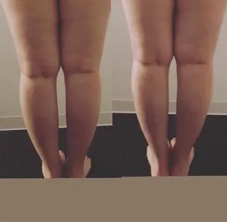 BESTUP 岐阜店のエステ・リラクイメージ