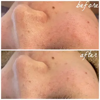 メンズ メナード岐阜市茜部 杉浦のエステ・リラクイメージ