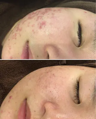 ミディアム カラー パーマ ヘアアレンジ メンズ キッズ ネイル マツエク・マツパ ニキビ・肌質改善専門 ♡人生が変わるサロンのエステ・リラクイメージ