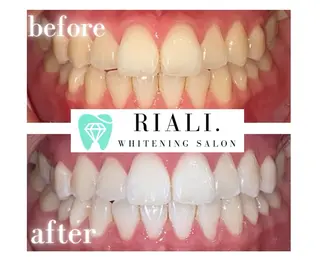 宮崎セルフホワイトニングサロンRIALI.所属・宮崎ホワイトニング サロンRIALI.のエステ・リラクイメージ