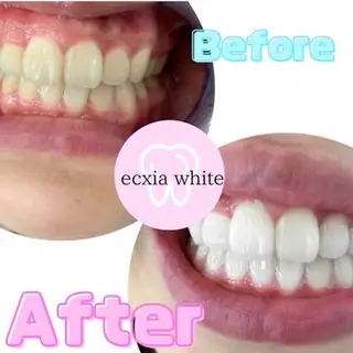 ecxia  white 　広島袋町店所属・セルフホワイトニング エクシア広島袋町店のその他イメージ