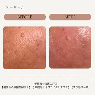 肌荒れに悩む方のため オイルフリーサロンのマツエク・マツパデザイン
