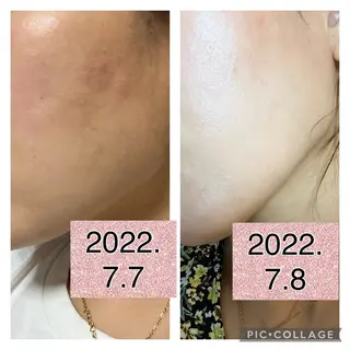 🅖🅤🅩🅔🅛 salonのエステ・リラクイメージ