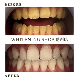 メンズ ホワイトニング ショップ葛西店のその他イメージ