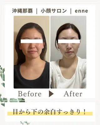 小顔サロンenne所属・小顔サロンenne 【エンネ】のその他イメージ