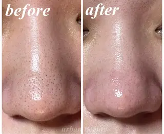 結果重視｜毛穴エステ ｜友綱理恵のエステ・リラクイメージ