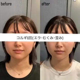 エステサロンino.colore'所属・小顔サロン ino.coloreのエステ・リラクイメージ