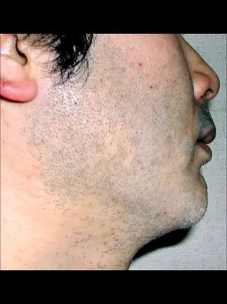 メンズ ☀️Akala☀️ メンズ脱毛のエステ・リラクイメージ