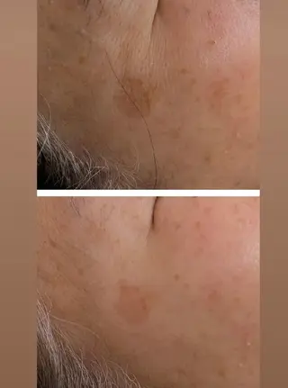 La Beaute所属・エステティックサロン La Beauteのエステ・リラクイメージ