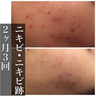 ミディアム カラー パーマ ヘアアレンジ メンズ キッズ ネイル マツエク・マツパ ニキビ・肌質改善専門 ♡人生が変わるサロンのエステ・リラクイメージ