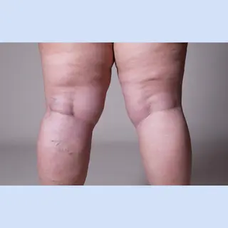 花田 亜由美のマツエク・マツパデザイン