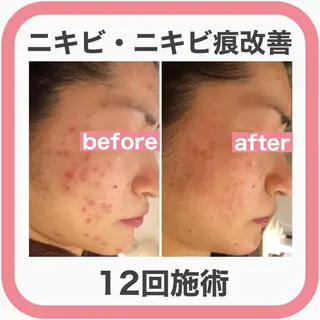 ミディアム カラー パーマ ヘアアレンジ メンズ キッズ ネイル マツエク・マツパ ニキビ・肌質改善専門 ♡人生が変わるサロンのエステ・リラクイメージ