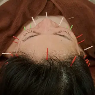 鍼灸サロンmiyabi所属・美容鍼×エステ　鍼灸 サロンmiyabiのエステ・リラクイメージ