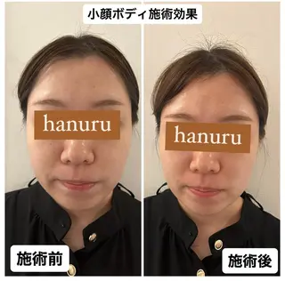 美容整体・小顔矯正 hanuruのエステ・リラクイメージ