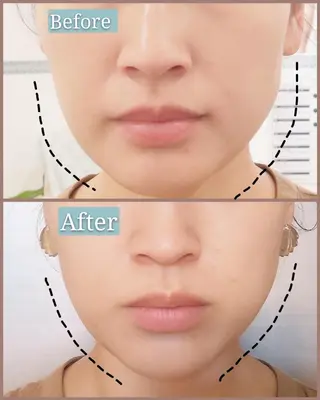 🅖🅤🅩🅔🅛 salonのエステ・リラクイメージ