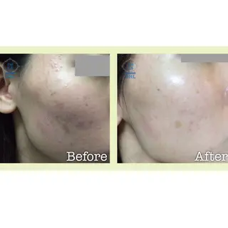 小顔コルギSalon de ETULEのエステ・リラクイメージ