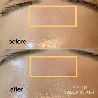 脱毛＆エステサロン JIGGLY☆松田のエステ・リラクイメージ